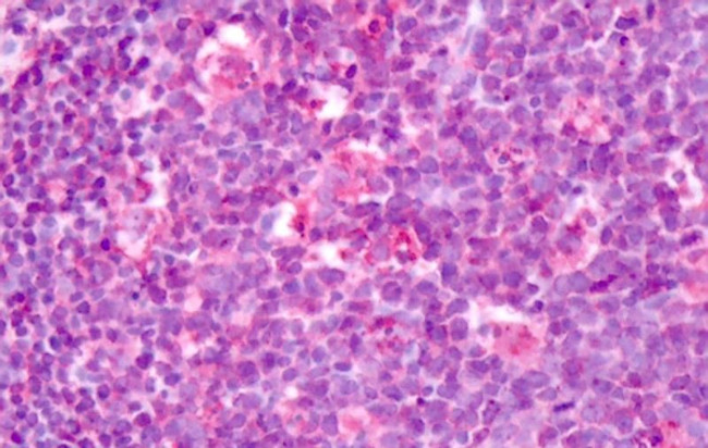 LPHN3 Antibody in Immunohistochemistry (Paraffin) (IHC (P))