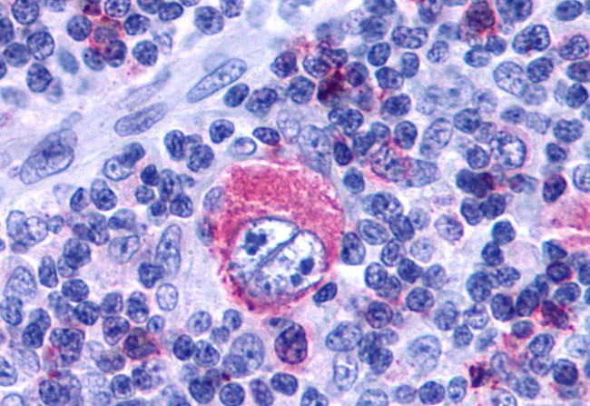 LTB4R2 Antibody in Immunohistochemistry (Paraffin) (IHC (P))