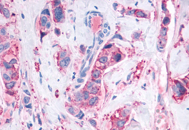 MAS1 Antibody in Immunohistochemistry (Paraffin) (IHC (P))