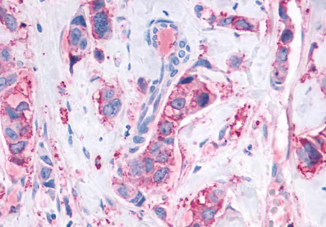 MAS1 Antibody in Immunohistochemistry (Paraffin) (IHC (P))