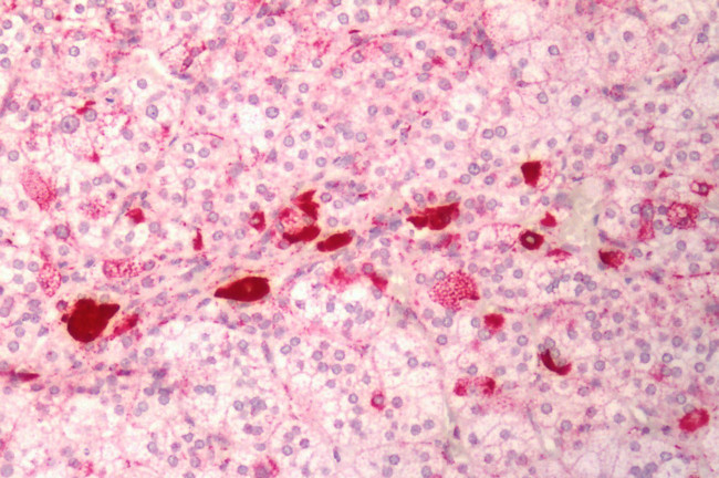 MC1R Antibody in Immunohistochemistry (Paraffin) (IHC (P))