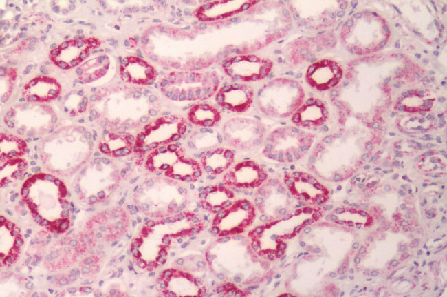 MC1R Antibody in Immunohistochemistry (Paraffin) (IHC (P))