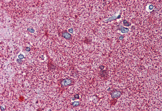 MC3R Antibody in Immunohistochemistry (Paraffin) (IHC (P))