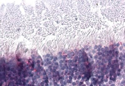 PNR Antibody in Immunohistochemistry (Paraffin) (IHC (P))