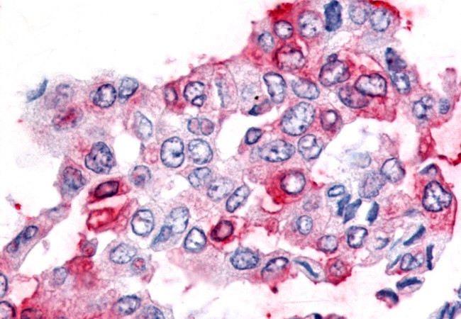 GCNF Antibody in Immunohistochemistry (Paraffin) (IHC (P))