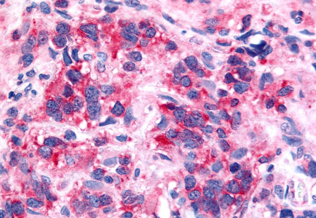 NTSR2 Antibody in Immunohistochemistry (Paraffin) (IHC (P))