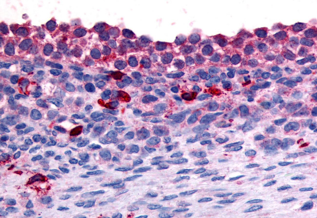 NR4A1 Antibody in Immunohistochemistry (Paraffin) (IHC (P))