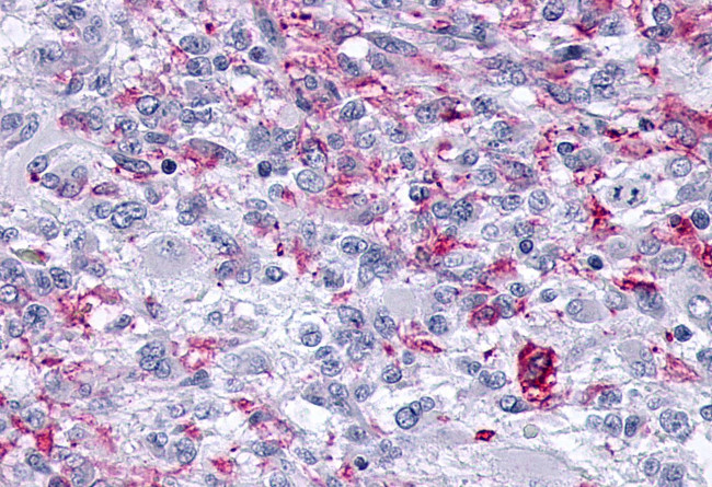 OPRM1 Antibody in Immunohistochemistry (Paraffin) (IHC (P))