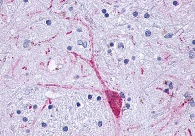 OPRM1 Antibody in Immunohistochemistry (Paraffin) (IHC (P))