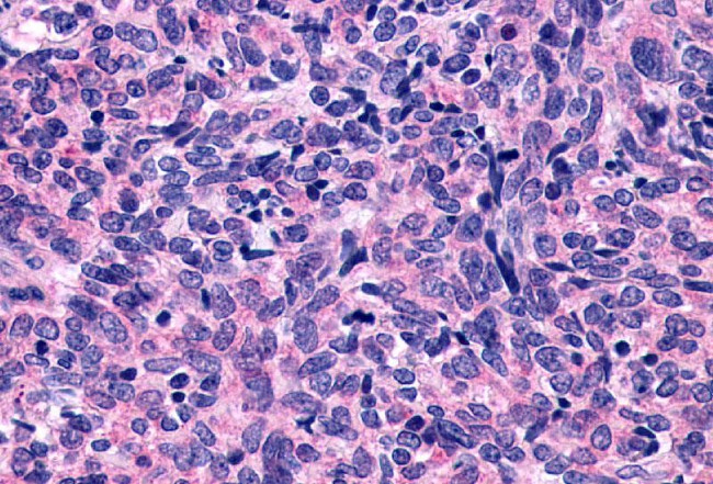 P2Y10 Antibody in Immunohistochemistry (Paraffin) (IHC (P))