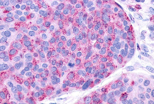 P2Y10 Antibody in Immunohistochemistry (Paraffin) (IHC (P))