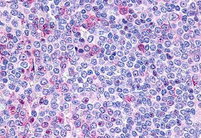 P2Y10 Antibody in Immunohistochemistry (Paraffin) (IHC (P))