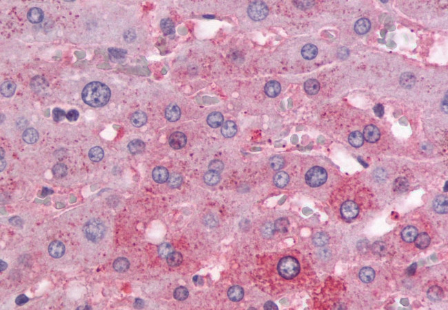 PTH1R Antibody in Immunohistochemistry (Paraffin) (IHC (P))