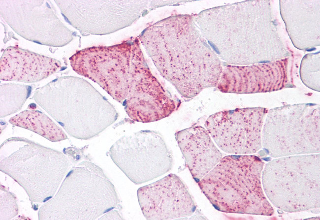 PTPRA Antibody in Immunohistochemistry (Paraffin) (IHC (P))