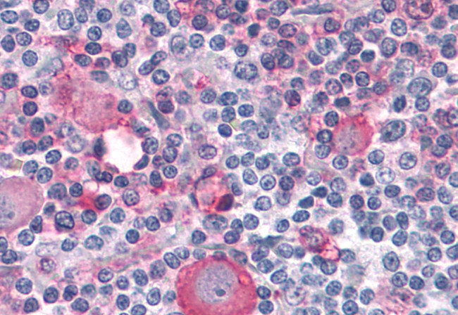 PTPRA Antibody in Immunohistochemistry (Paraffin) (IHC (P))