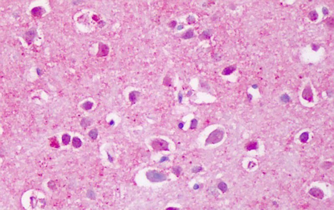 PTPRA Antibody in Immunohistochemistry (Paraffin) (IHC (P))