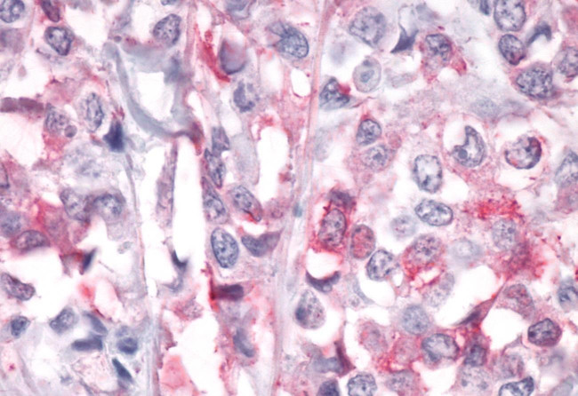 PTPRA Antibody in Immunohistochemistry (Paraffin) (IHC (P))