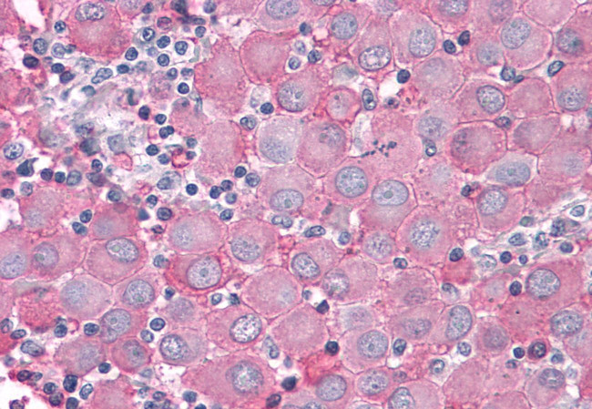 PTPRA Antibody in Immunohistochemistry (Paraffin) (IHC (P))