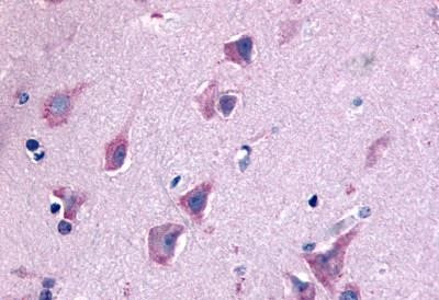 QRFPR Antibody in Immunohistochemistry (Paraffin) (IHC (P))