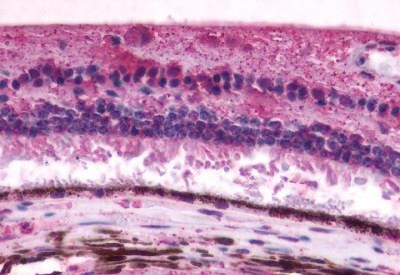 RGR Antibody in Immunohistochemistry (Paraffin) (IHC (P))