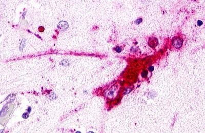 LGR7 Antibody in Immunohistochemistry (Paraffin) (IHC (P))