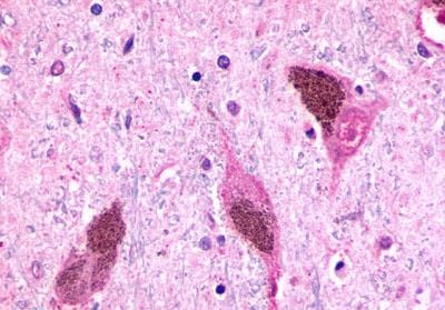 RXFP3 Antibody in Immunohistochemistry (Paraffin) (IHC (P))