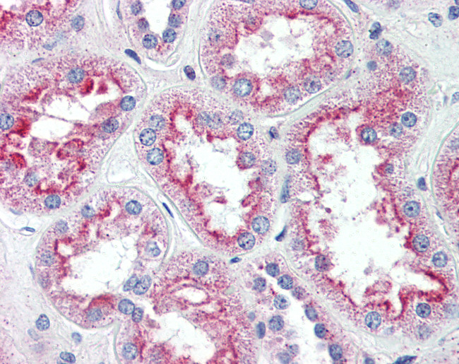 SLC5A11 Antibody in Immunohistochemistry (Paraffin) (IHC (P))