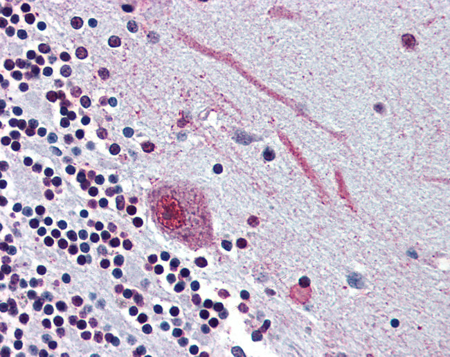 SLC5A9 Antibody in Immunohistochemistry (Paraffin) (IHC (P))