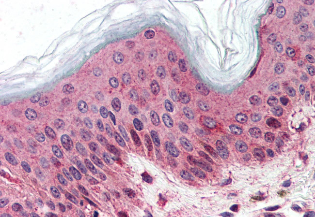 SLC5A9 Antibody in Immunohistochemistry (Paraffin) (IHC (P))