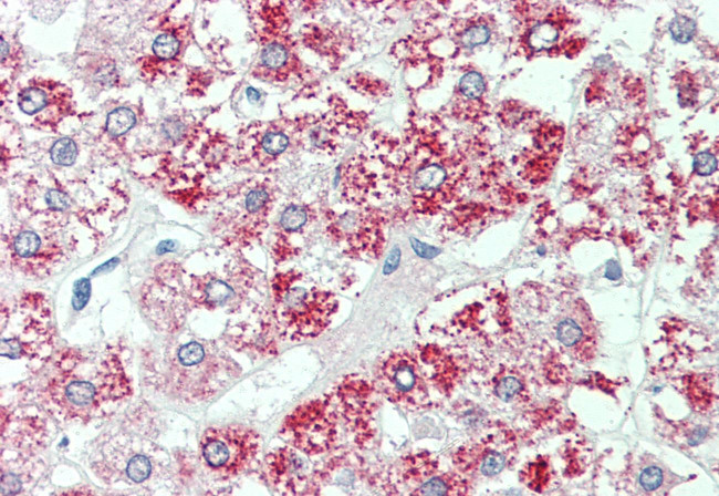 SLC7A2 Antibody in Immunohistochemistry (Paraffin) (IHC (P))