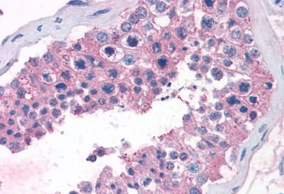 TAS1R1 Antibody in Immunohistochemistry (Paraffin) (IHC (P))