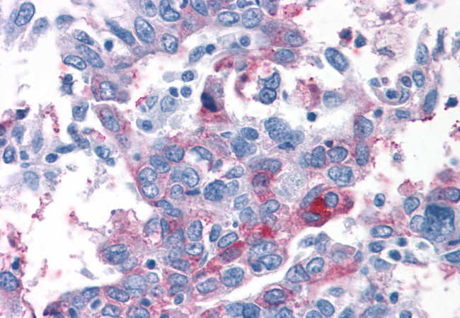 TAS1R1 Antibody in Immunohistochemistry (Paraffin) (IHC (P))