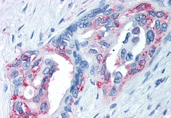 TRPM8 Antibody in Immunohistochemistry (Paraffin) (IHC (P))