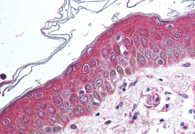 WNT10B Antibody in Immunohistochemistry (Paraffin) (IHC (P))