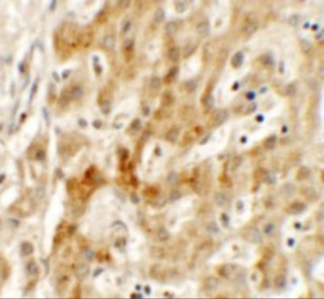 TMEM106B Antibody in Immunohistochemistry (IHC)