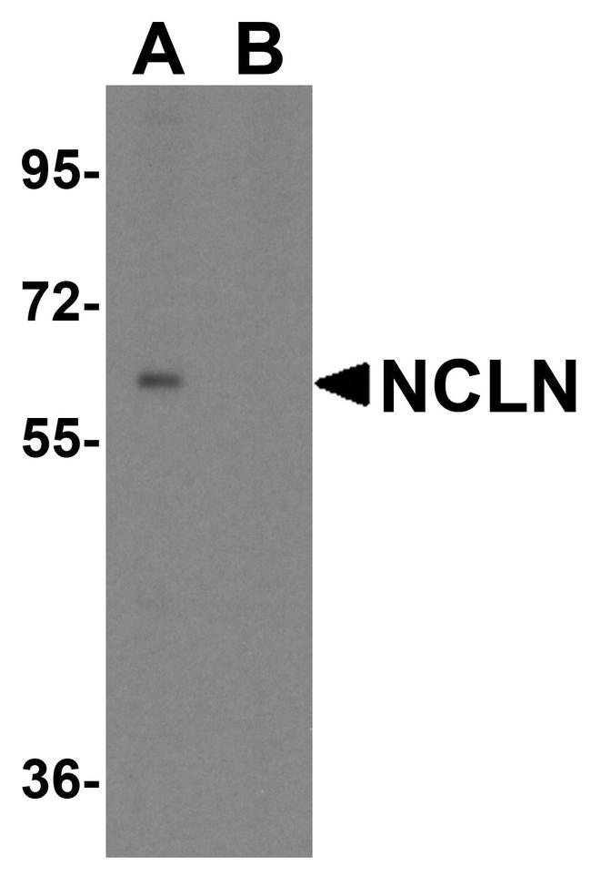 NCLN Antibody in Western Blot (WB)