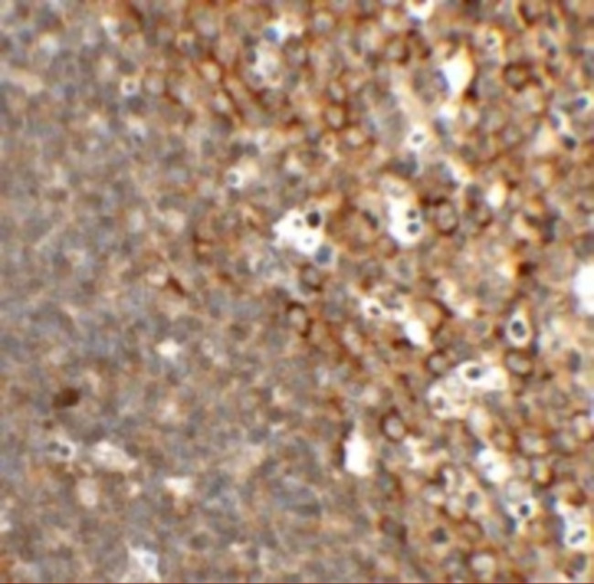 TFCP2L1 Antibody in Immunohistochemistry (IHC)