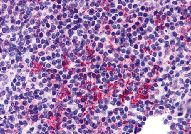 ZNF687 Antibody in Immunohistochemistry (IHC)