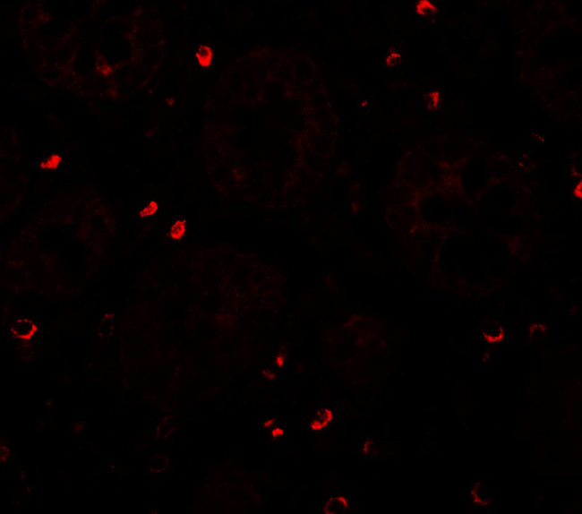 ZFX Antibody in Immunohistochemistry (IHC)