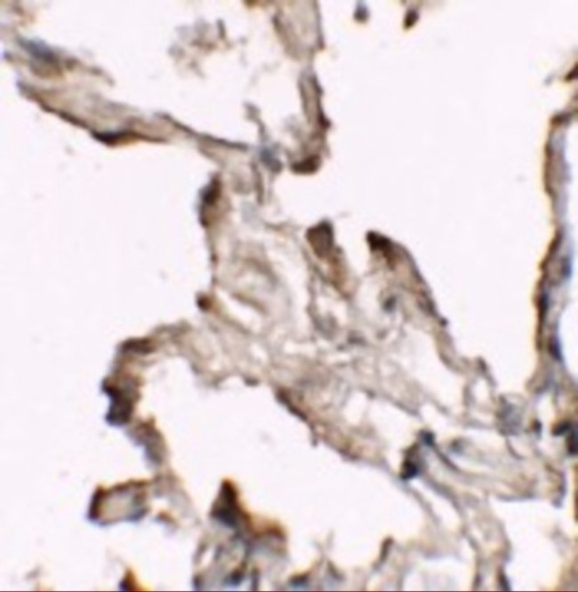 NBS1 Antibody in Immunohistochemistry (IHC)