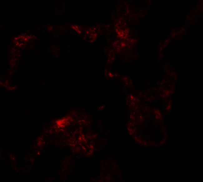 NBS1 Antibody in Immunohistochemistry (IHC)