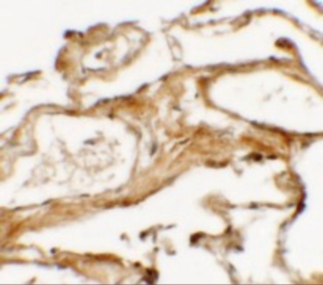 NBS1 Antibody in Immunohistochemistry (IHC)