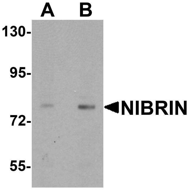 NBS1 Antibody in Western Blot (WB)