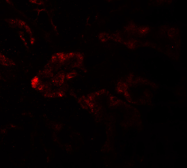 RAB21 Antibody in Immunohistochemistry (IHC)