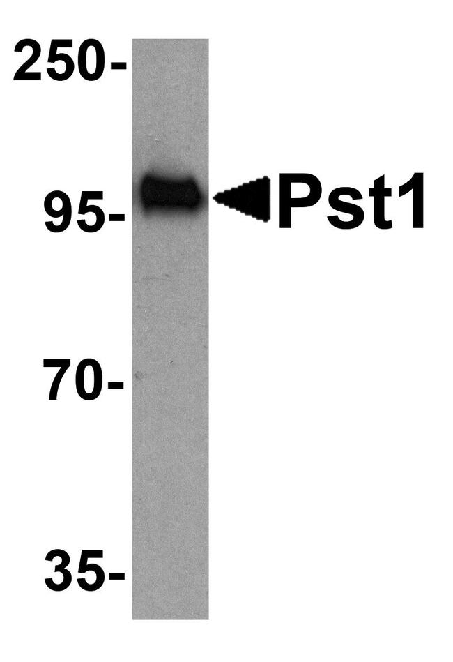 PST1 Antibody in Western Blot (WB)