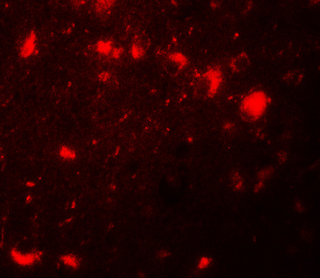 CBX4 Antibody in Immunohistochemistry (IHC)