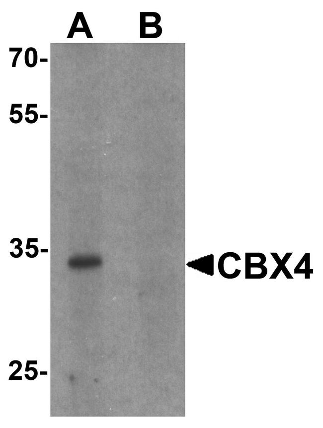 CBX4 Antibody in Western Blot (WB)