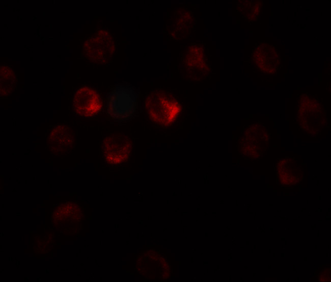 TCTEX1D1 Antibody in Immunocytochemistry (ICC/IF)