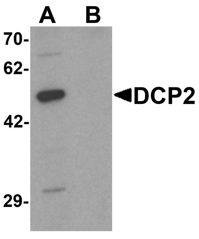 DCP2 Antibody in Western Blot (WB)