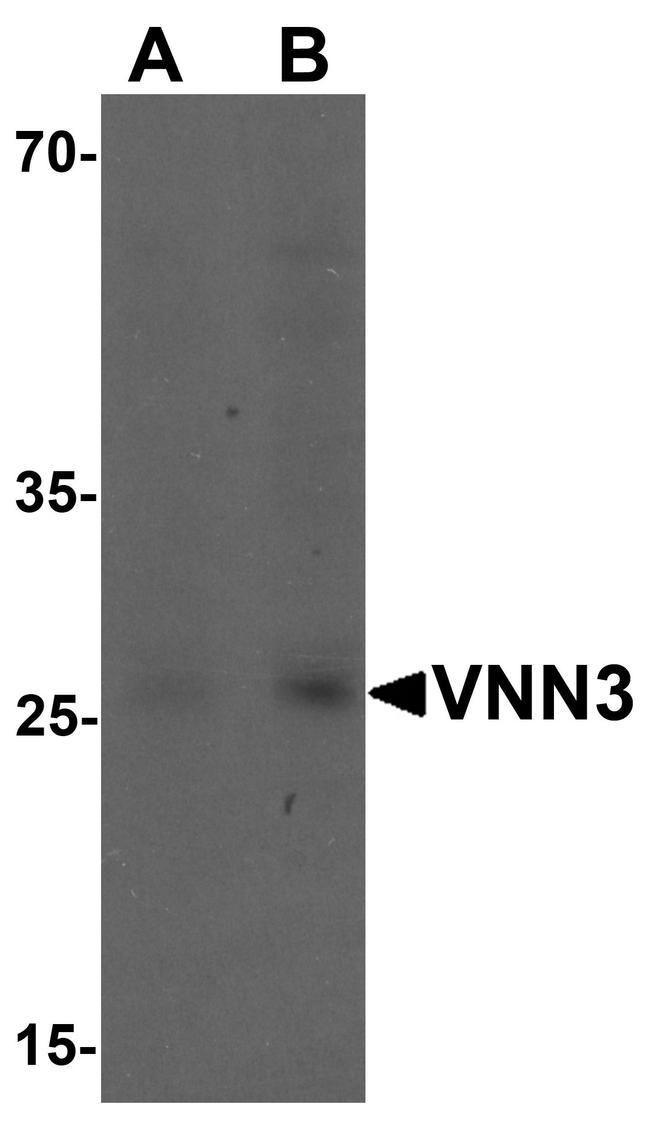 VNN3 Antibody in Western Blot (WB)